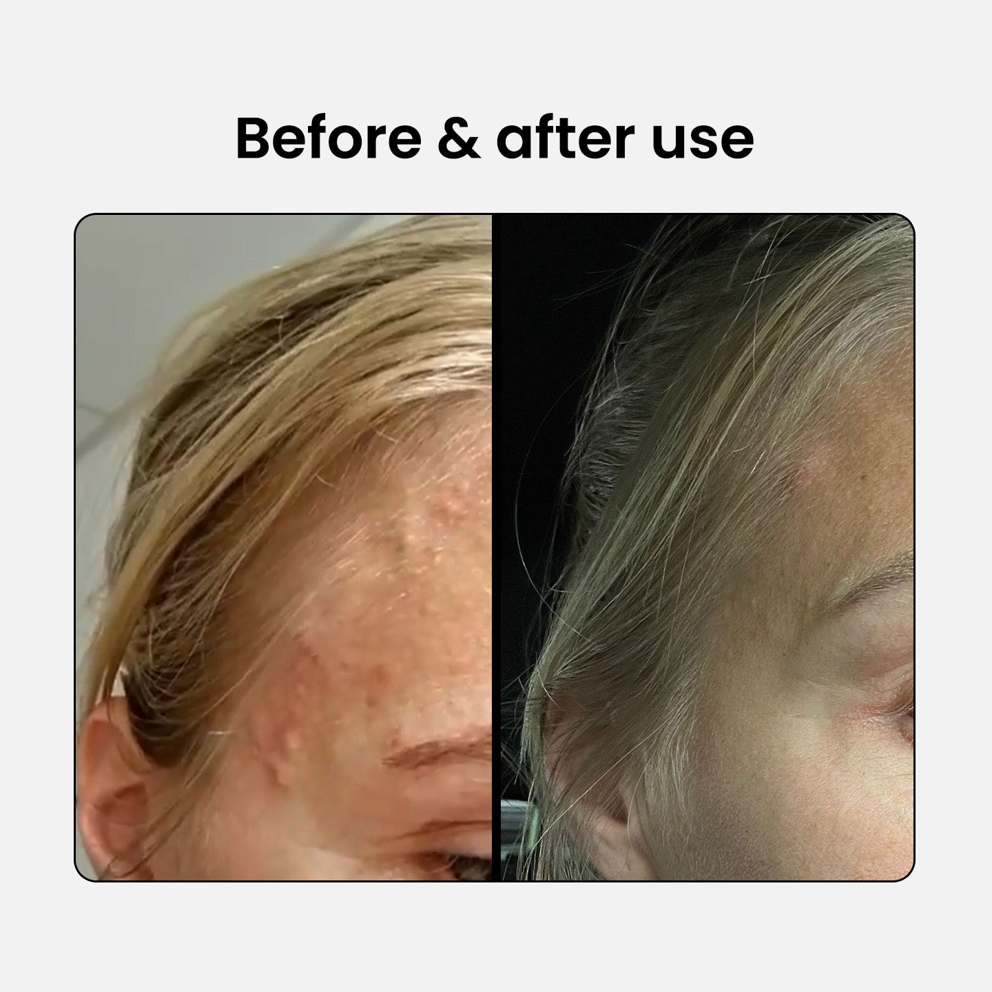 2% BHA Exfoliating Cleanser
