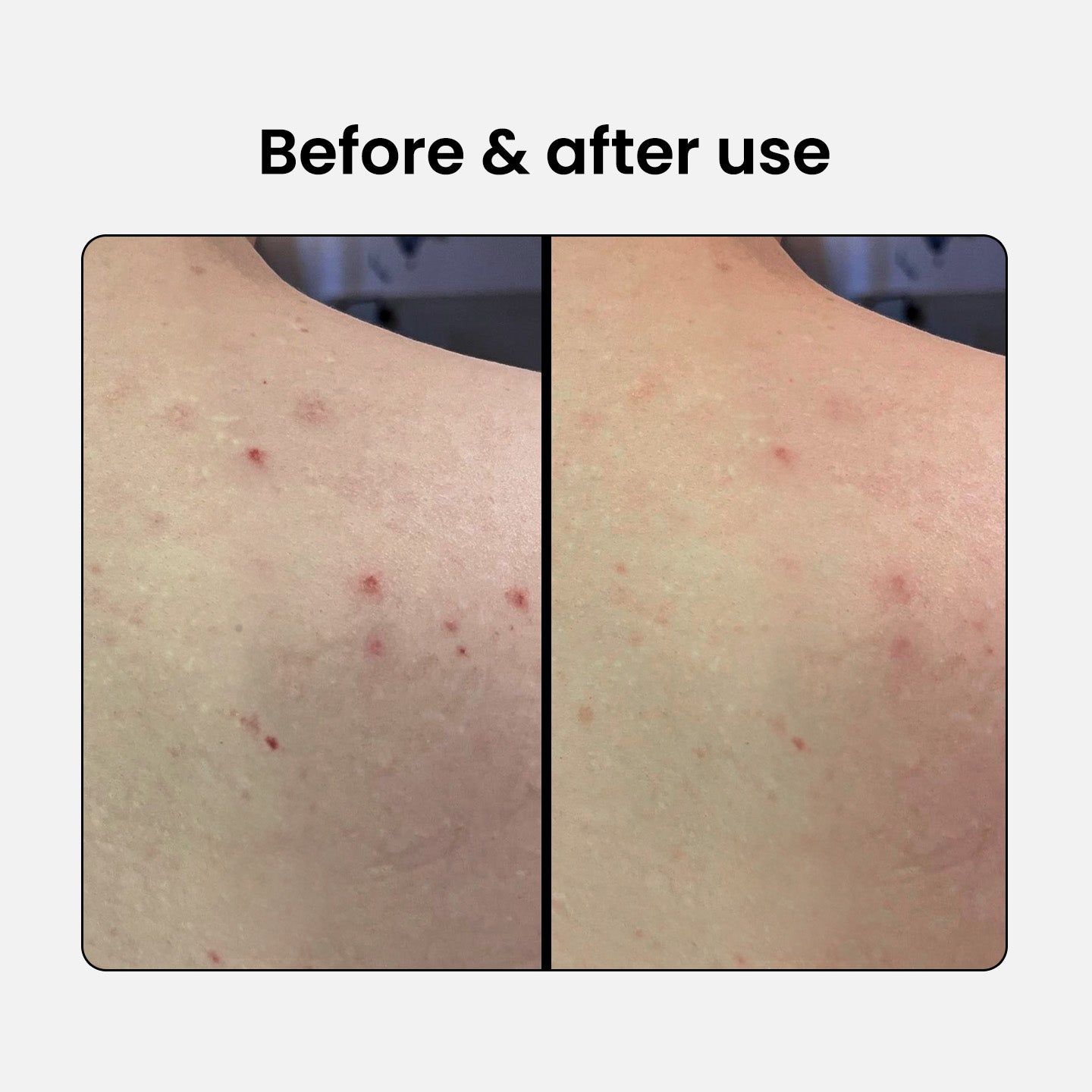 2% BHA Exfoliating Body Spray