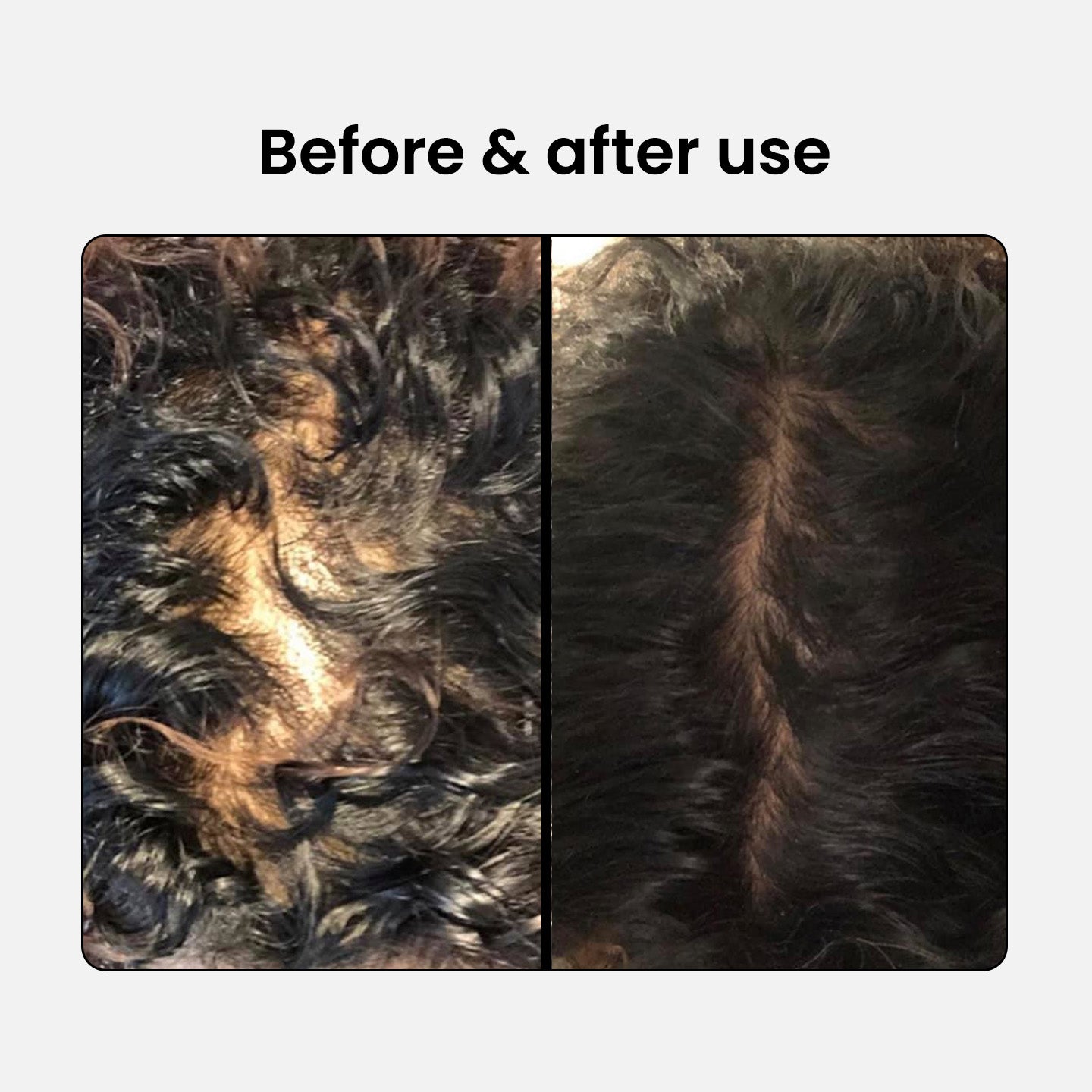 Anti-Hair Loss Shampoo