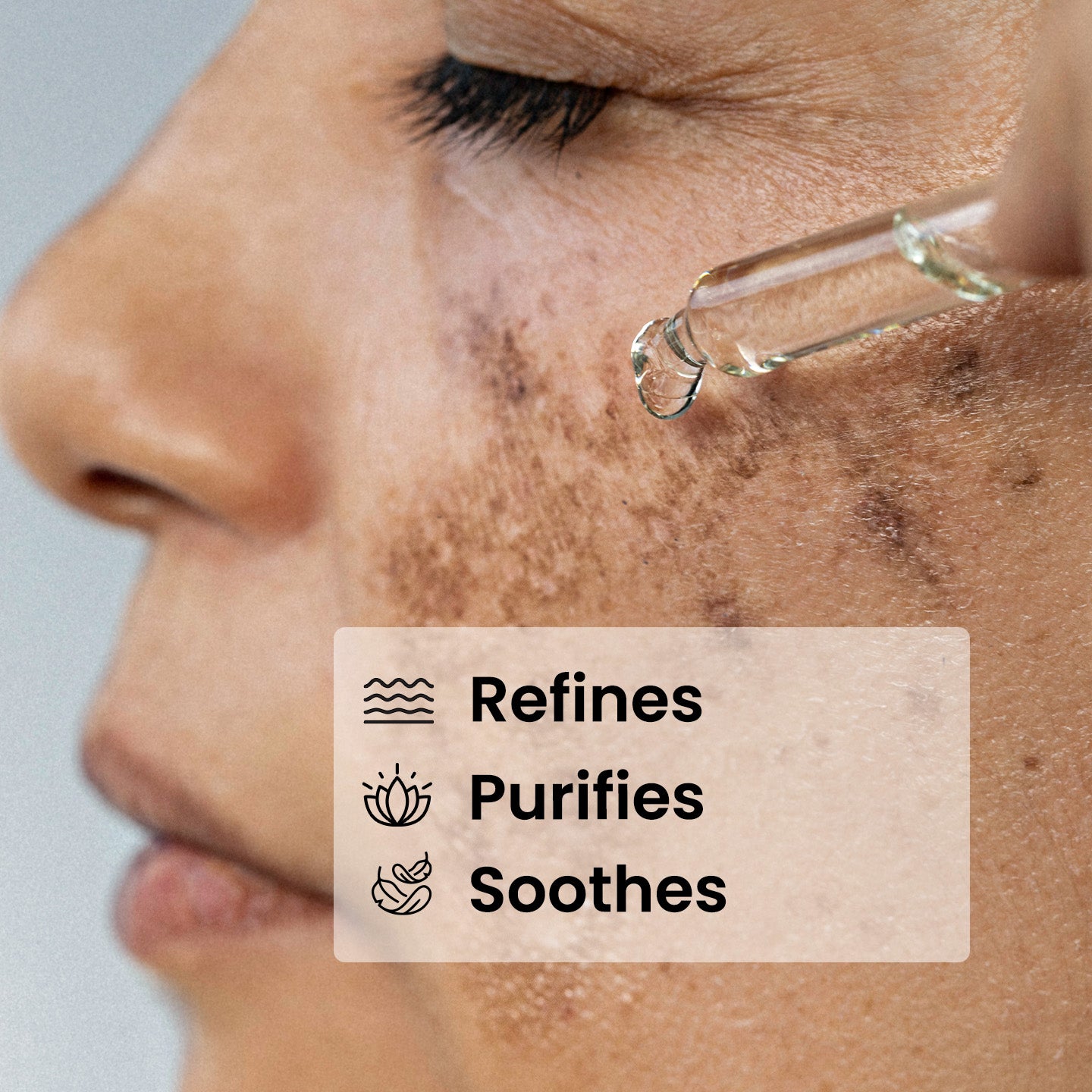 10% Niacinamide Serum