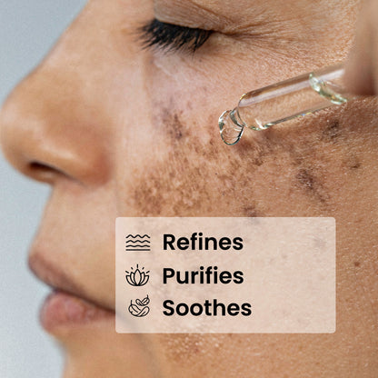 10% Niacinamide Serum