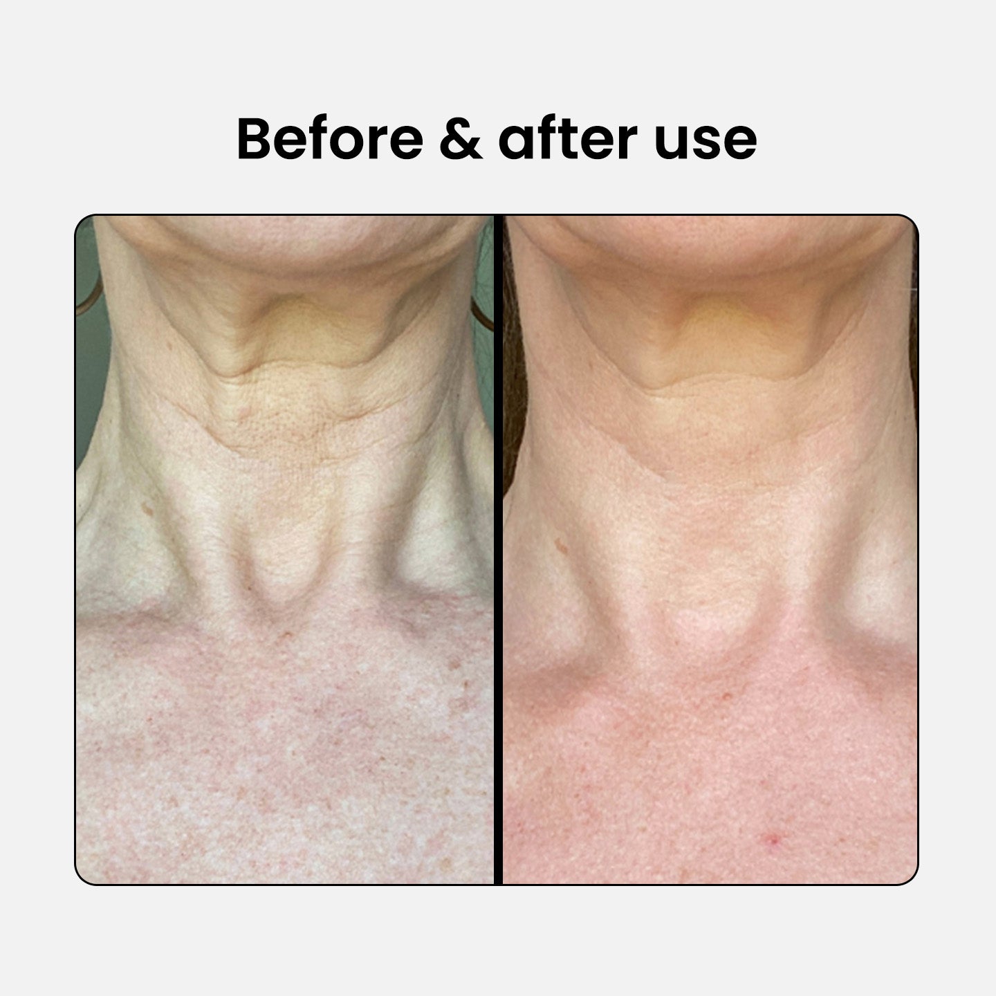 Peptide Firming Neck and Décolleté Serum