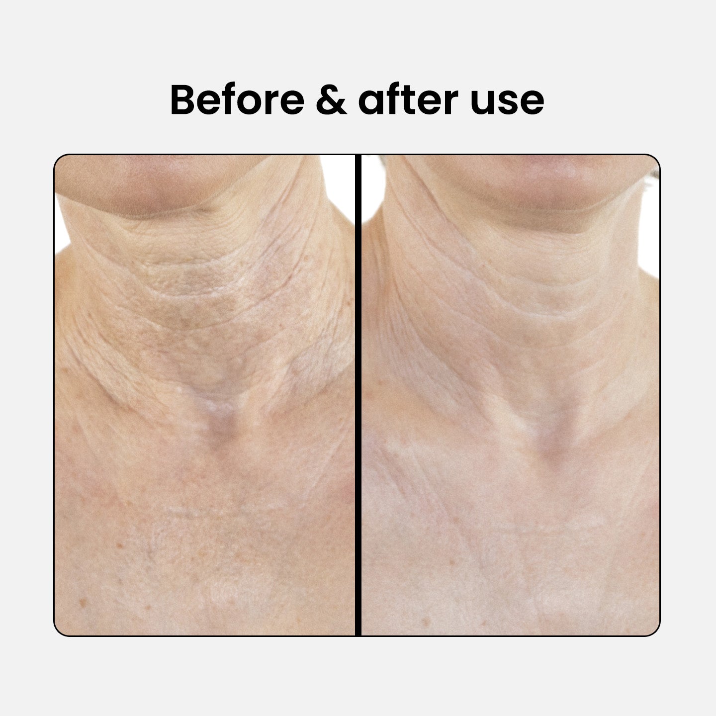 Peptide Firming Neck and Décolleté Lotion