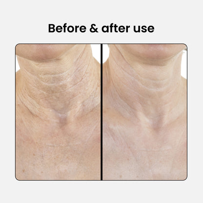 Peptide Firming Neck and Décolleté Lotion
